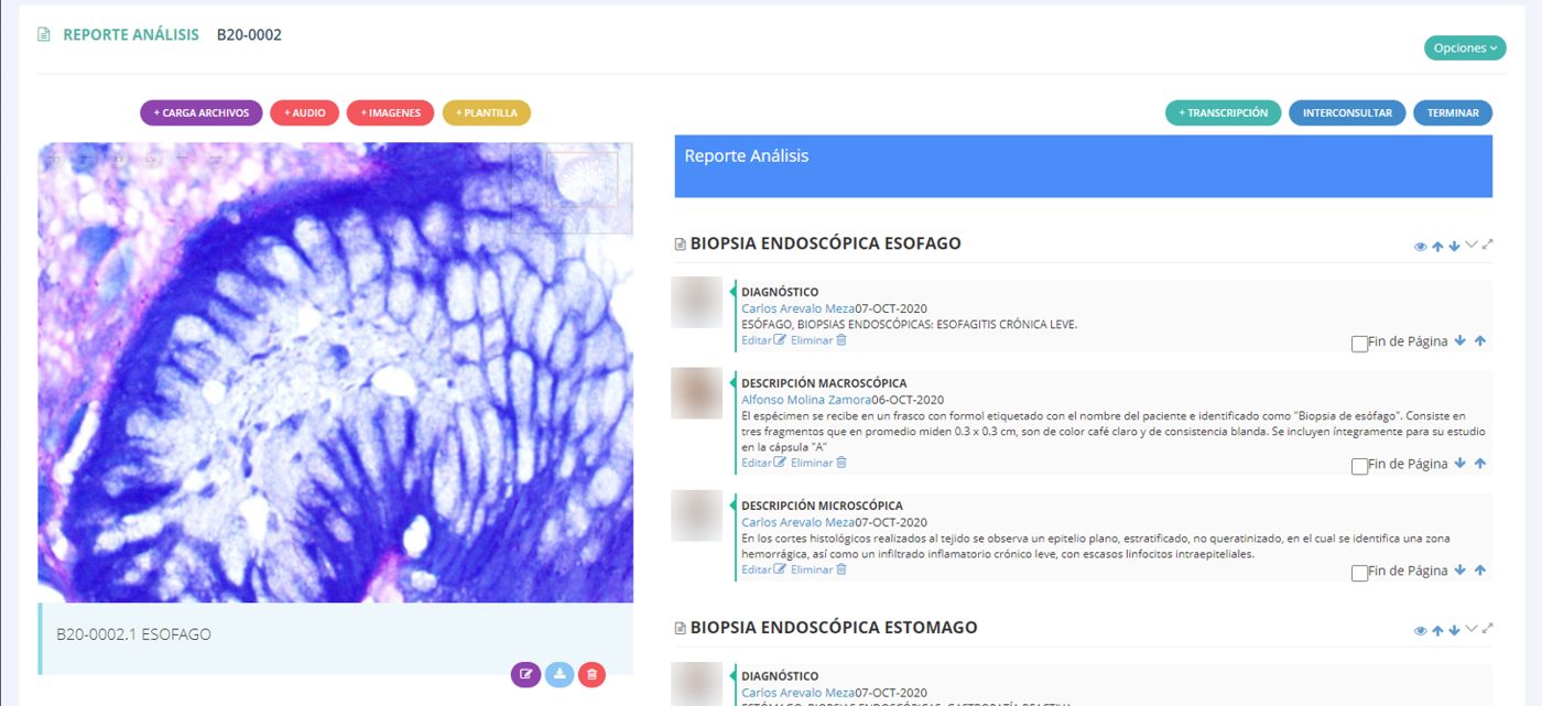 Pantalla de interpretación de Patología360: imagen microscópica de una biopsia y reporte con diagnóstico y descripciones macro y microscópica